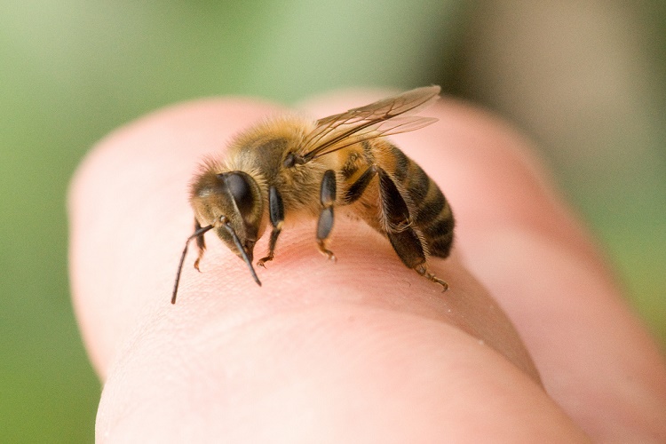 bee-sting-home-remedies