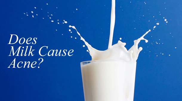 does-milk-cause-acne-2